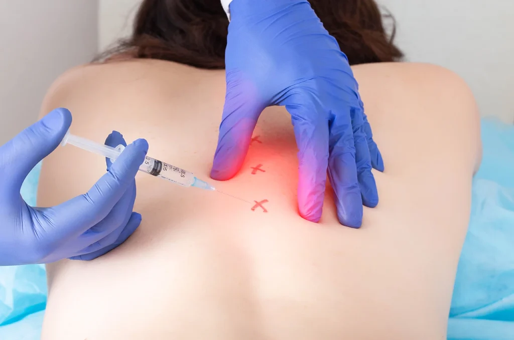 complete guide to trigger point injection therapy