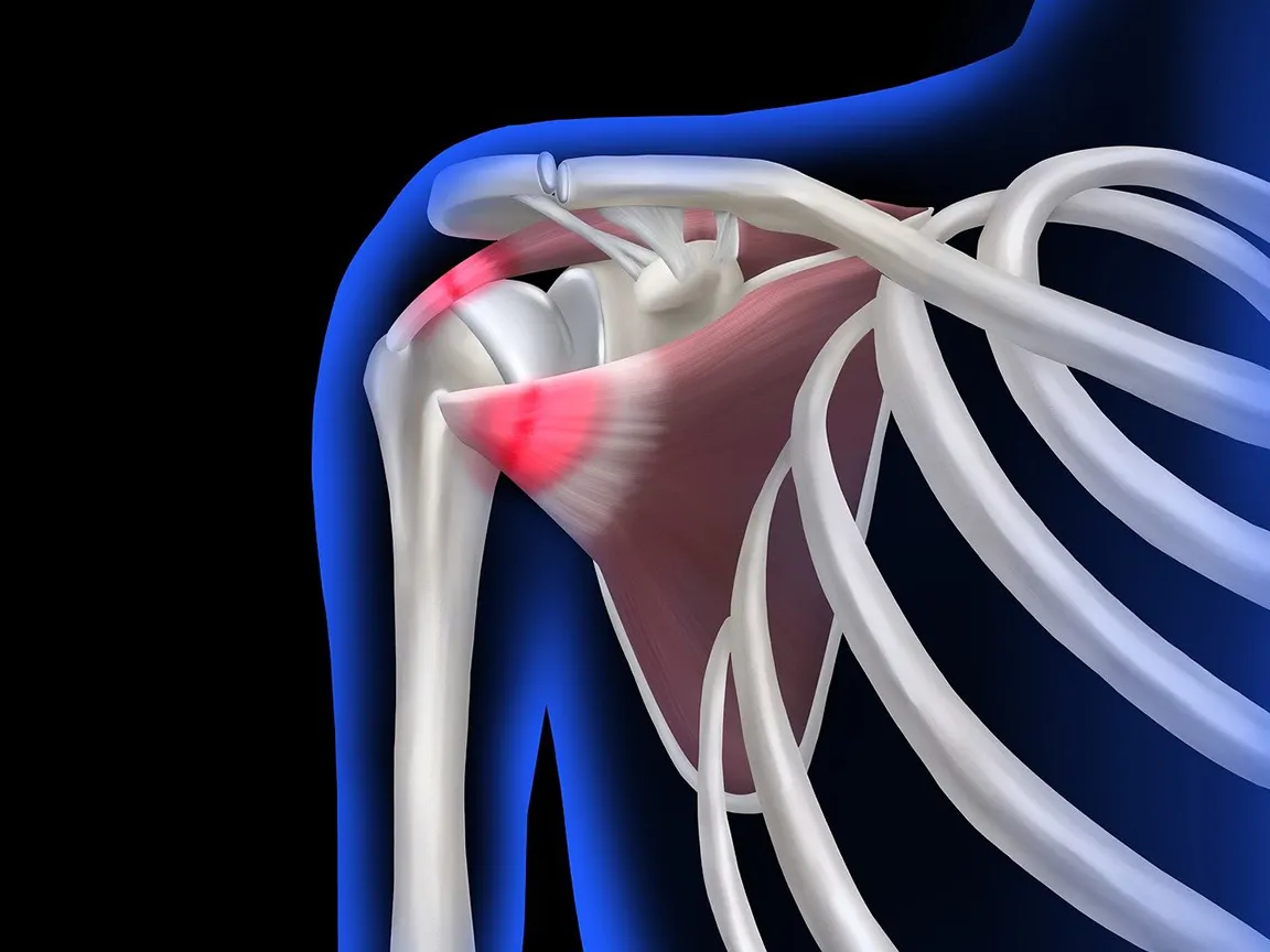 rotator cuff tear symptoms